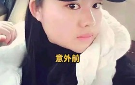 男子照顾大面积烧伤女友6年